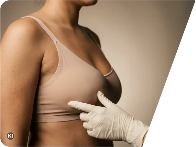 Seitliche Ansicht eines Oberkörpers einer Frau in einem hautfarbenen BH mit einer Hand in medizinischem Handschuh, die die Brust berührt