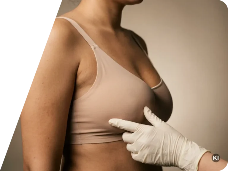Seitliche Ansicht eines Oberkörpers einer Frau in einem hautfarbenen BH mit einer Hand in medizinischem Handschuh, die die Brust berührt
