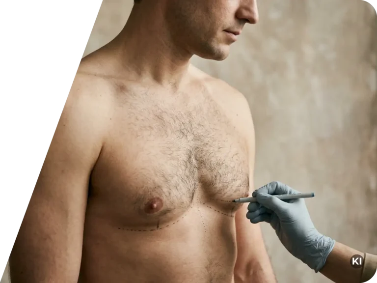 Oberkörper eines Mannes mit Brusthaaren, auf dessen Brust eine gepunktete Linie mit einem Stift markiert wird