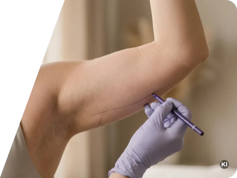 Oberarm mit angehobenen Arm und einer Hand in medizinischem Handschuh, die mit einem Stift eine Markierung auf der Haut setzt